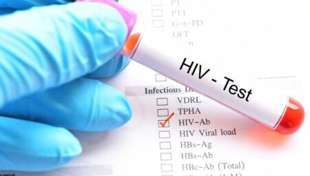 HIV Bağışıklık Sistemini Nasıl Etkiler? CD4 Hücrelerinin Rolü ve Derin Analizi
